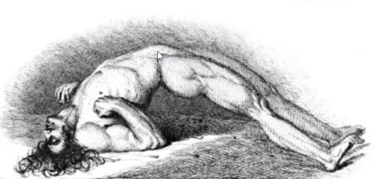 Science by a Scientist: On Tetanus